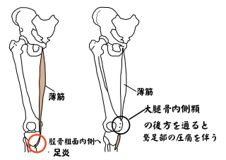肩凝り