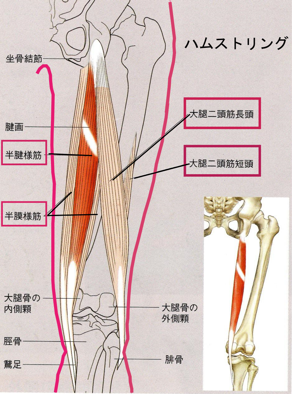 骨盤後傾